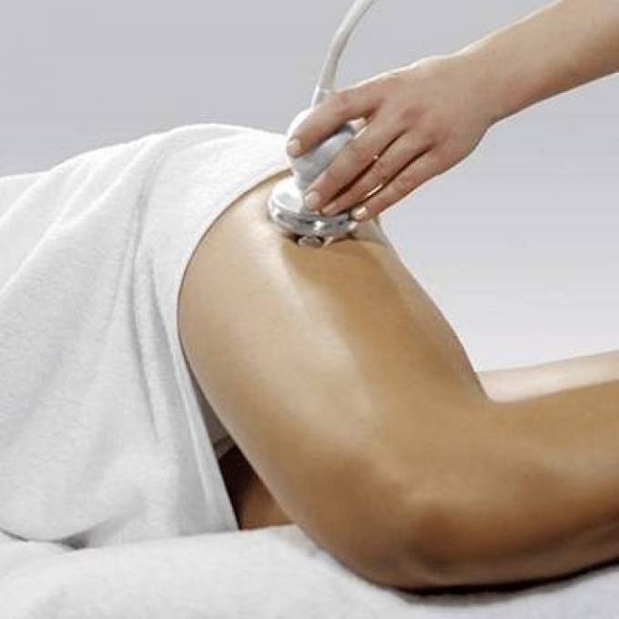 How Do You Prepare for Fat Injections?