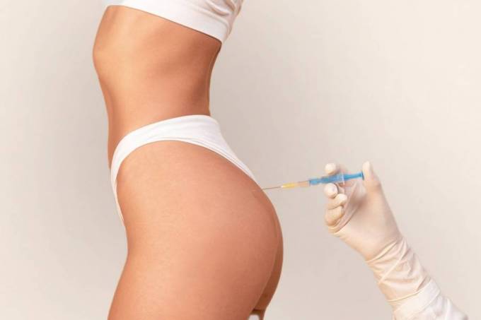 How Long Does It Take to Recover from a Brazilian Butt Lift?
