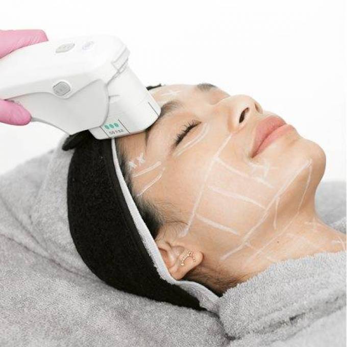How Does Ultherapy Treatment Work Wonders?