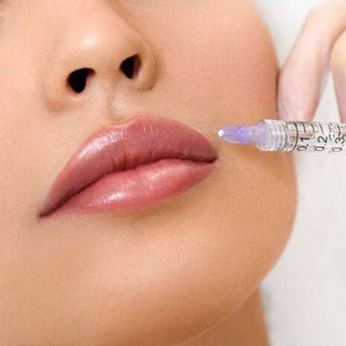 How Long Do Lip Filler Injections Last?