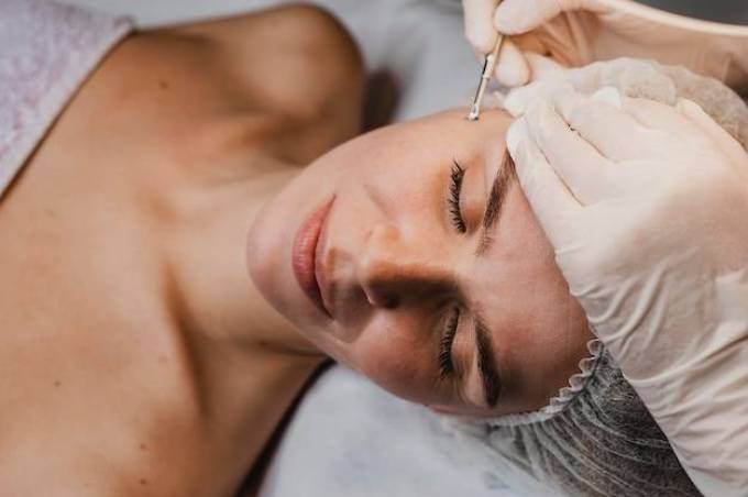 How Does Acne Scar Treatment Work?
