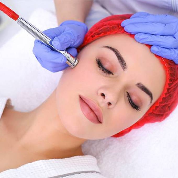 How Does Acne Scar Treatment Work?