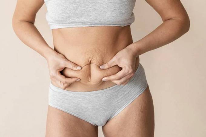 How Does a Tummy Tuck Transform You?