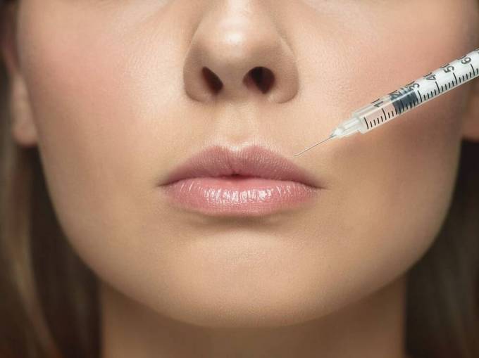 How Do Lip Fillers Injections Work?