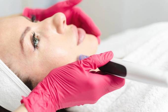 How Does Microneedling Improve Skin?