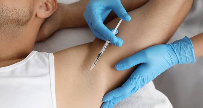 How Does Botox for Sweaty Gland Work?