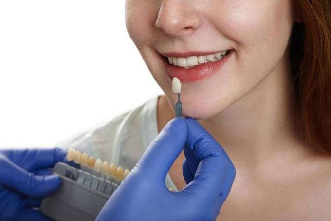 How Do Dental Crowns & Bridges Work?