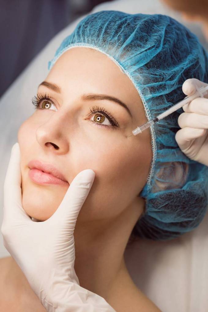 Why Choose Sculptra Fillers Today?