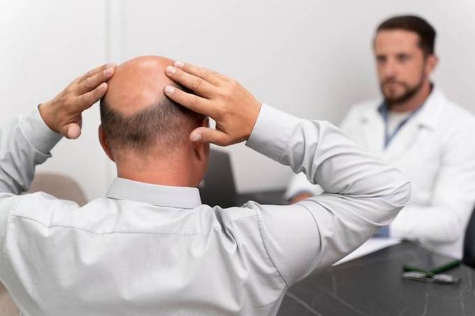 Can hair loss at the crown be reversed?