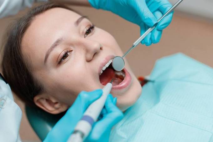 How Much Does Teeth Whitening Cost?