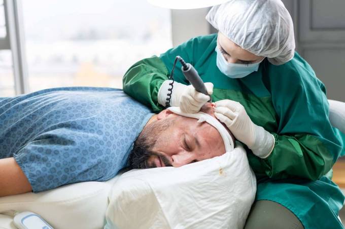 Does a Hair Transplant Look Good in Older Men?