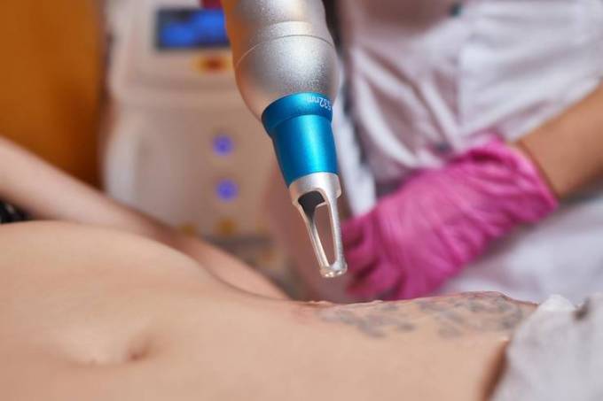 Why Do Some Tattoos Resist Laser Removal?