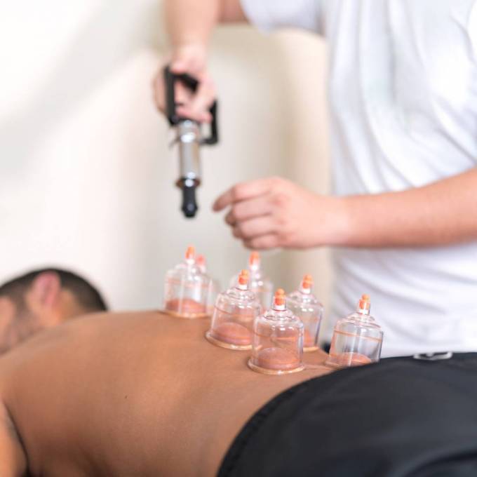 Does Hijama Wet Cupping Therapy Detox You?