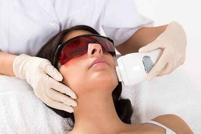 Is Laser Hair Removal Safe on Facial Skin?