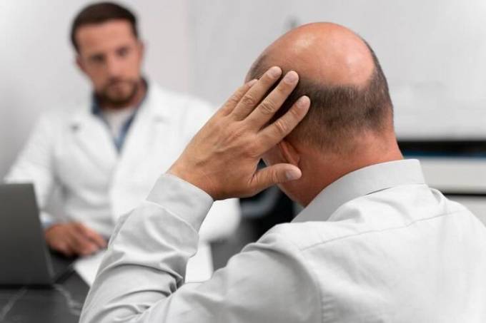 What Factors Affect the Best Hair Transplant?