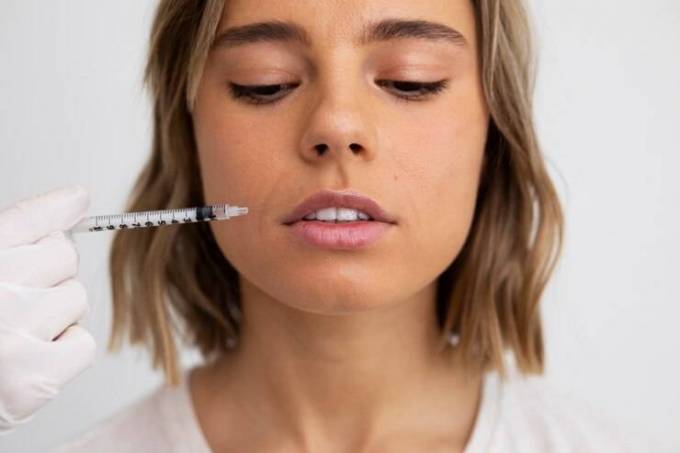 What Age Is Best for Volbella Fillers?