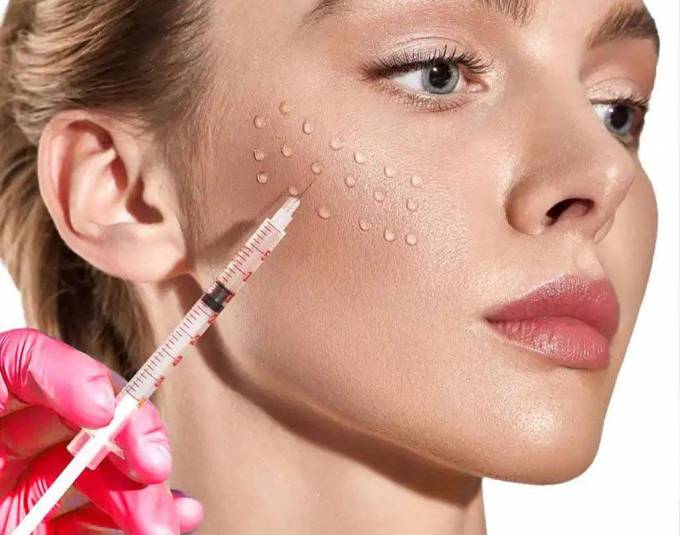 Is the Mesotherapy Cost Covered by Insurance?