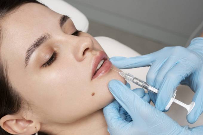 Does Filler Injections With PRP Boost Collagen?