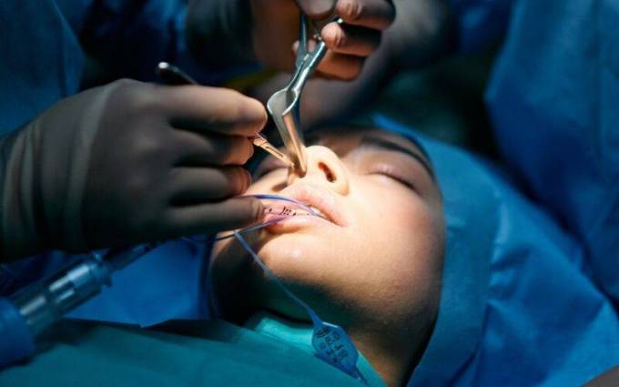 What Makes Someone an Ideal Candidate for Rhinoplasty?