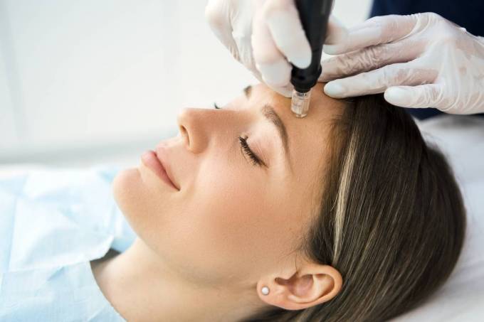 Is a Vampire Facelift Worth It?