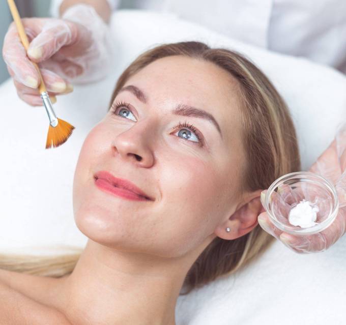 What to Expect During a PCA Peel Treatment?