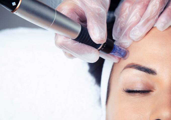 Is Dermapen Treatment Suitable for All Skin Types?
