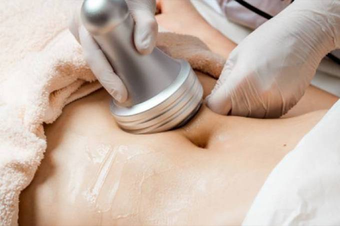 What Are the Ideal Candidates for Lipolysis Treatment?