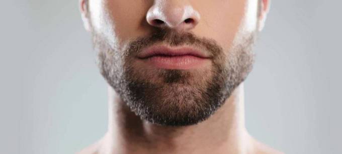 What Are the Mustache Hair Transplant Aftercare Tips?