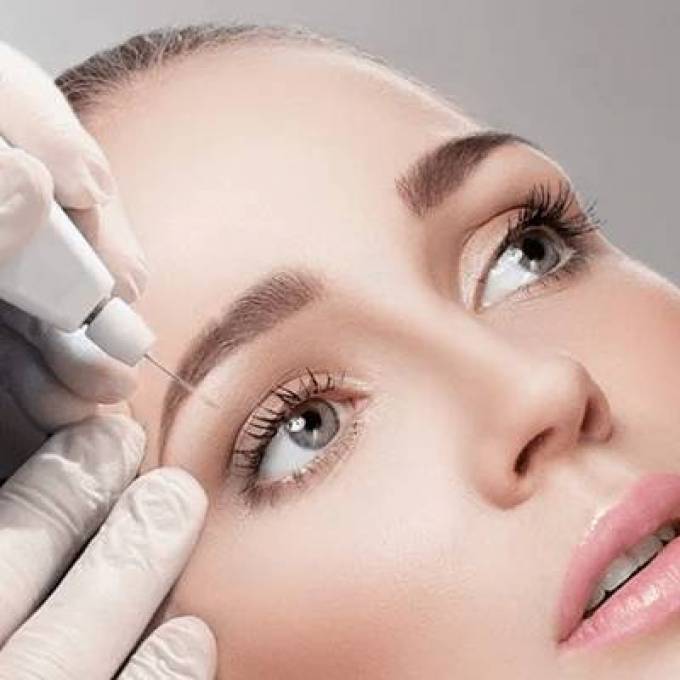 How Often Should You Get Plasma Pen Treatment?