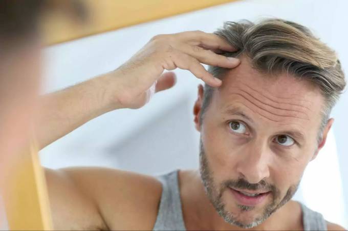 Is Hair Loss Treatment More Effective for Men or Women?