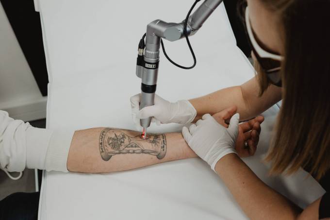 How Does The Picosure Tattoo Removal Wavelength Function?