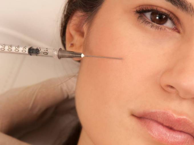 What Makes Radiesse Fillers Unique?