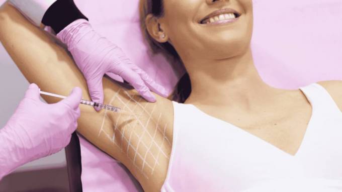 How Do Sweat Glands Respond to Botox Treatment?