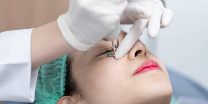 Does Fotona 4D For Facelift Require An Incision Or Cut?