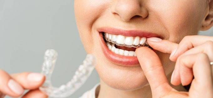 What Is the Best Aligner for Complex Alignment Issues?