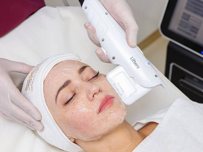 Does a Non-Surgical Facelift Improve Skin Tone?