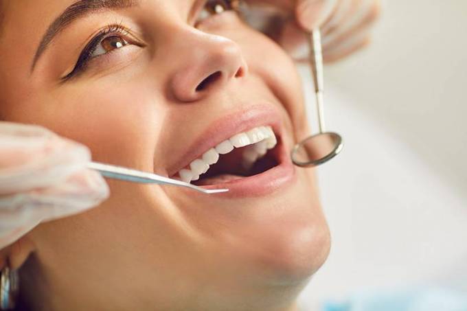 What Is the Purpose of Getting a Dental Tooth Filling?