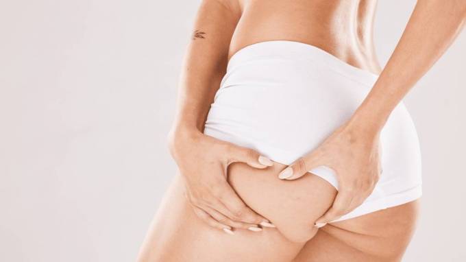 What Is the Role of HYAcorp Fillers in Tissue Support?