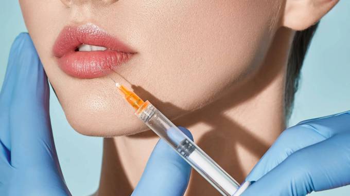 Is Volbella fillers for lips treatment a refined technique?