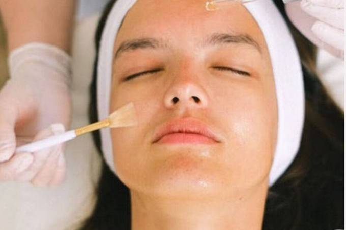 How Is Glycolic Acid Peel Treatment Integrated Into Skincare?