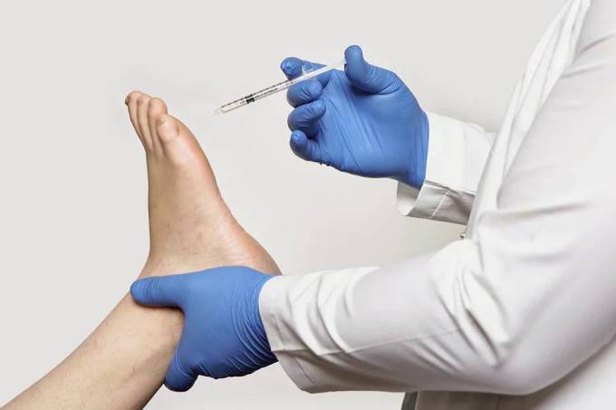Is Botox for Foot Sweating a Safe Option?