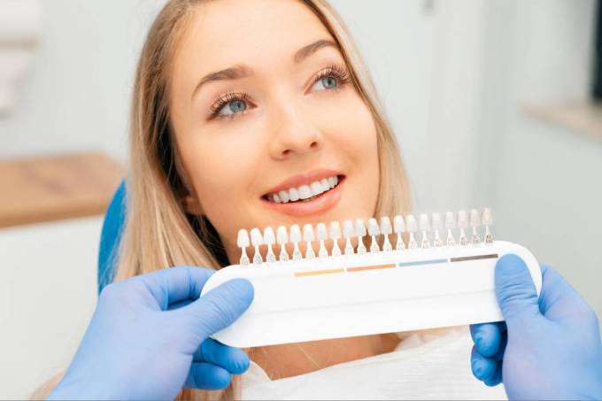 What Does the Dental Veneers Consultation Involve?