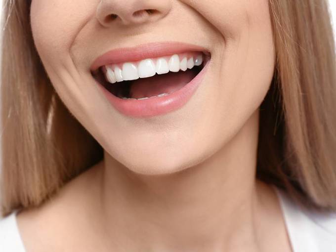 What Shapes a Hollywood Smile Makeover?