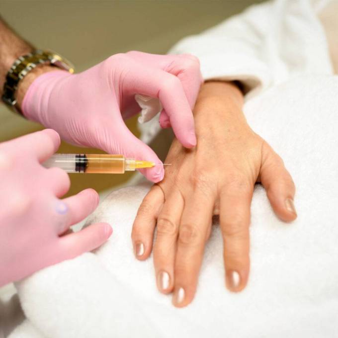 What the Hand Rejuvenation Process Involves?