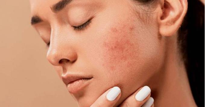 How Skin Diseases Treatment Addresses Causes