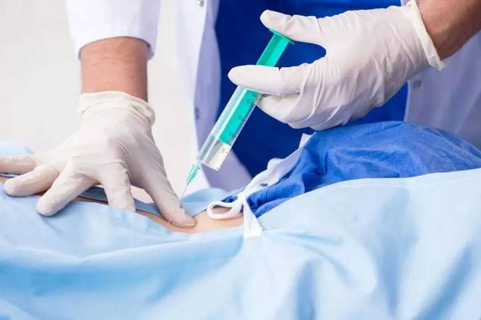 Is IV Ozone Therapy Pain Relief a Medical Option?