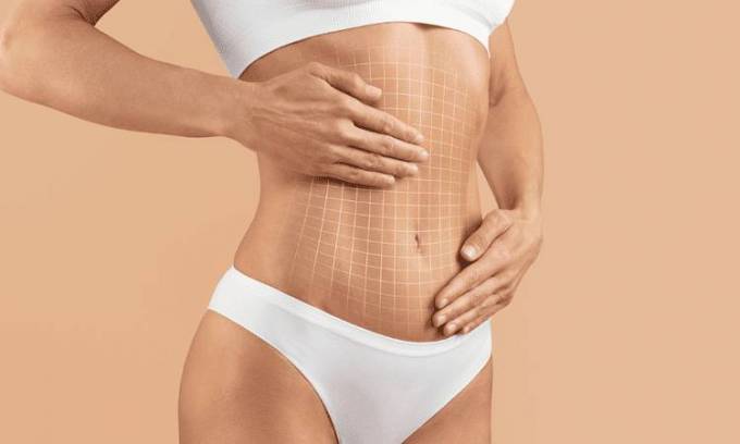 How Is a Tummy Tuck Treatment Performed?