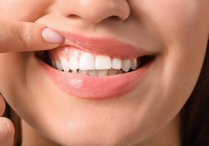 Painless Gum Depigmentation Treatment Options