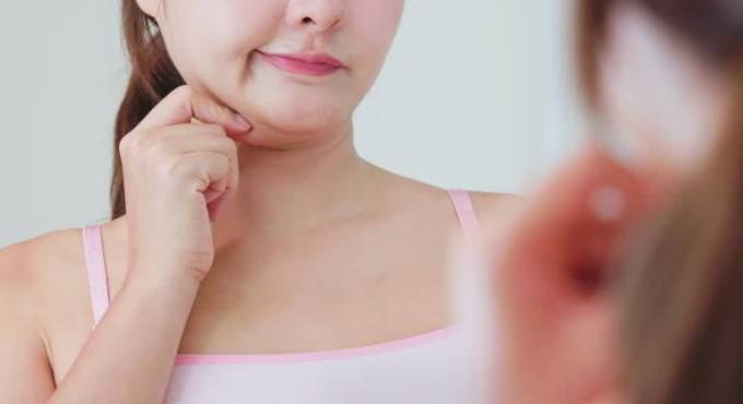 How Does Double Chin Removal Address Submental Fat?