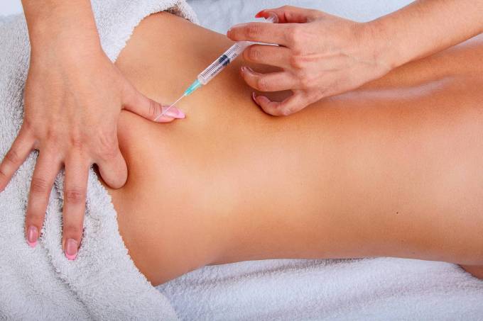 What Is the Regulatory Status of Body Fillers?
